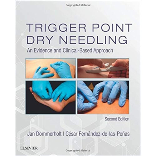 Trigger Point Dry Needling -2E