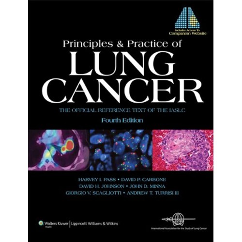 Principles & Practice of Lung Cancer - 4E