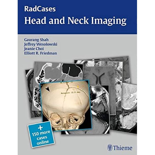 RadCases Head and Neck Imaging 1st Edition