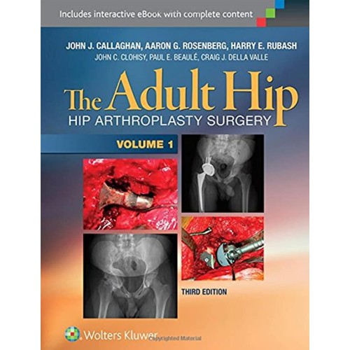 The Adult Hip (Two Volume Set): Hip Arthropla...