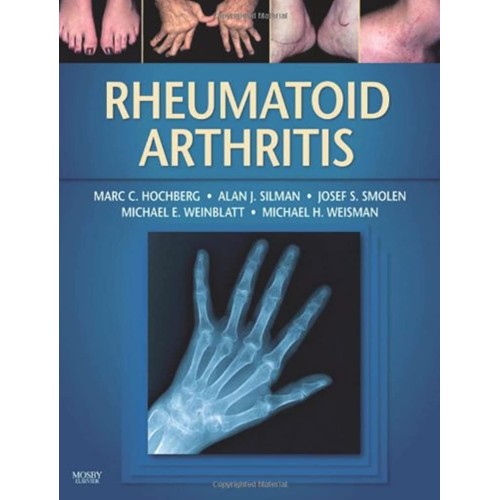 Rheumatoid Arthritis