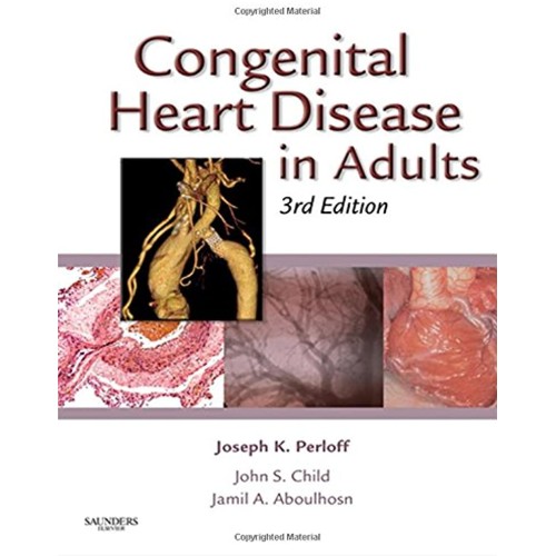 Cogenital Heart Disease/ Adults 3E