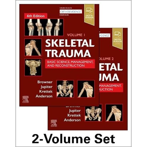 Skeletal Trauma - 6E