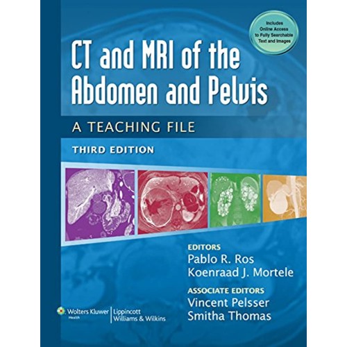 CT & MRI of the Abdomen and Pelvis: A Teaching - 3E