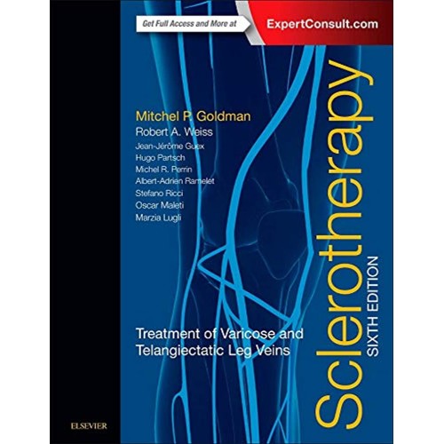 Sclerotherapy: Treatment of Varicose and Telangiectatic Leg Veins -6E