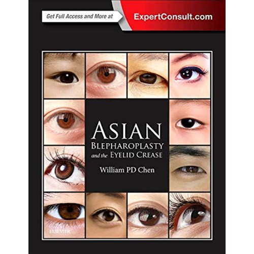 Asian Blepharoplasty and the Eyelid Crease: Expert Consult - Online and Print