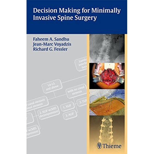 Decision Making for Minimally Invasive Spine ...