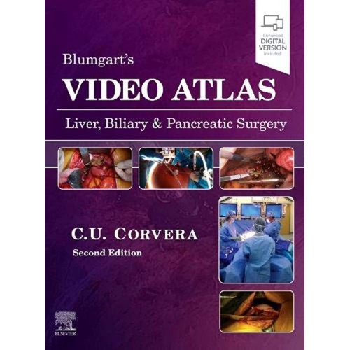 Video Atlas: Liver, Biliary & Pancreatic Surg...