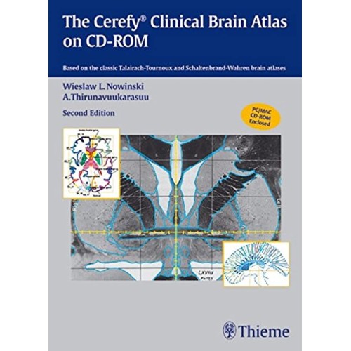 The Cerefy Clinical Brain Atlas/CD-ROM 2nd Ed...