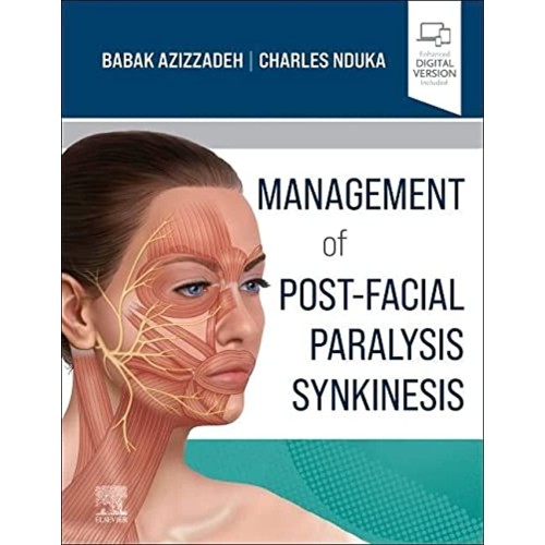 Management of Post-Facial Paralysis Synkinesis-1E