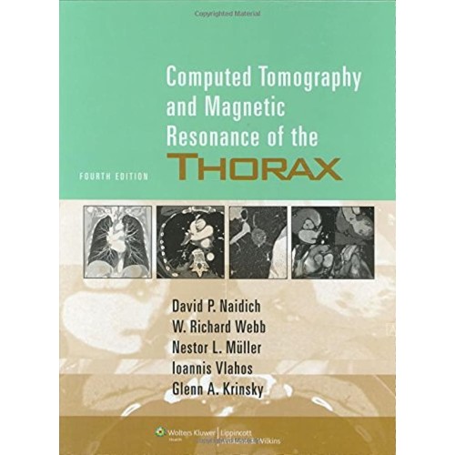 Computed Tomography & Magnetic Resonance of the Thorax - 4E