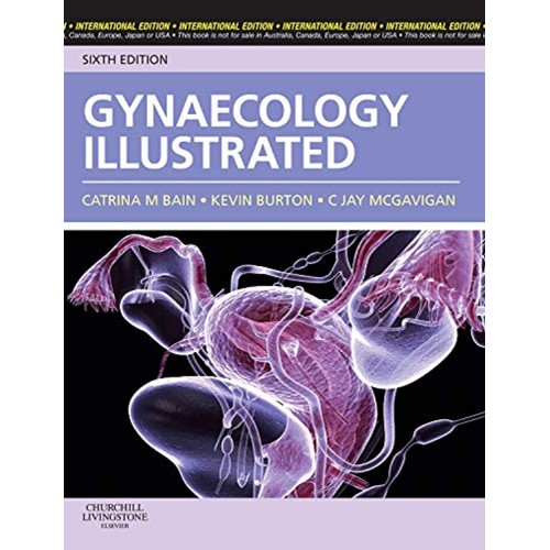 Gynaecology Illustrated 6/e