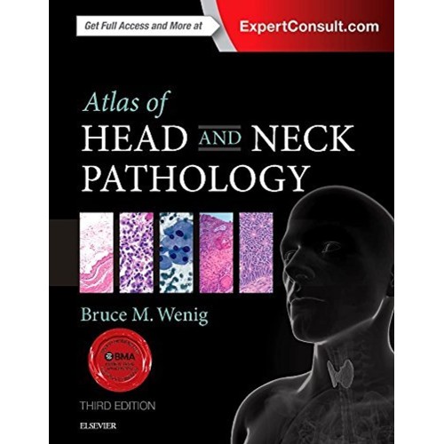 Atlas of Head and Neck Pathology - 3E