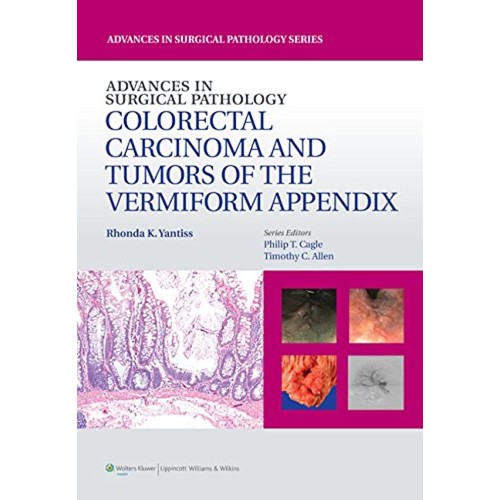 Advances in Surgical Pathology: Colorectal Carcinoma and Tumors of the Vermiform Appendix - 1E