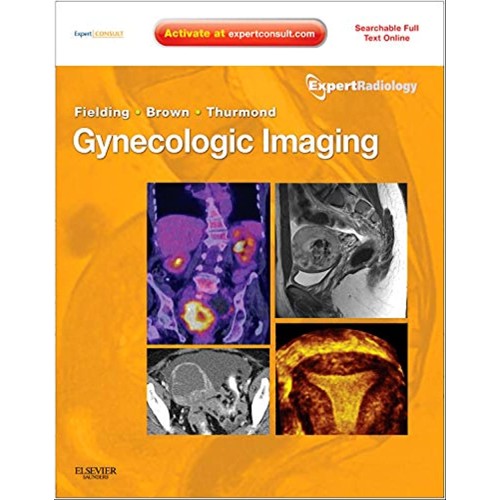 Gynecologic Imaging- Expert Radiology Series -1E