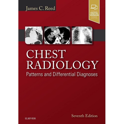 Chest Radiology: Patterns and Differential Diagnoses -7E