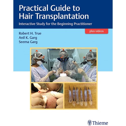 Practical Guide to Hair Transplantation 1st E...