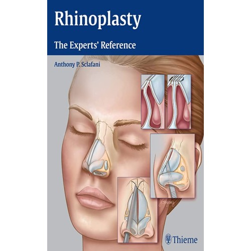 Rhinoplasty The Experts' Reference 1st Ed.