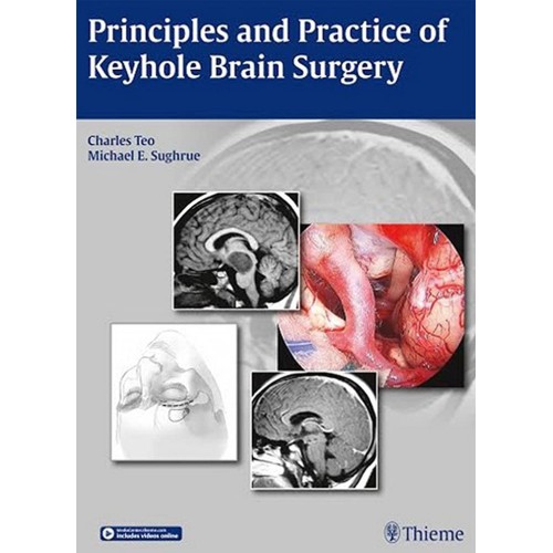 Principles and Practice of Keyhole Brain Surgery 1st Ed