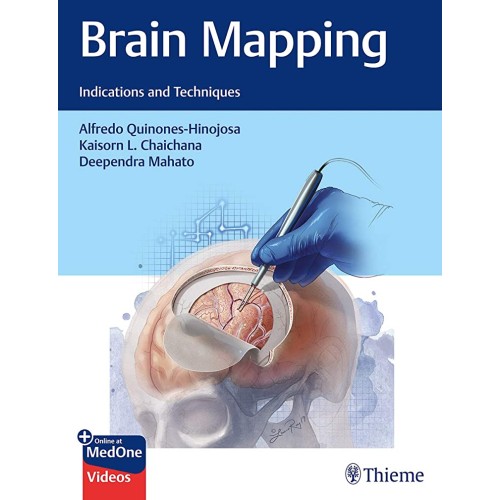 Brain Mapping : Indications and Techniques 1st Ed.