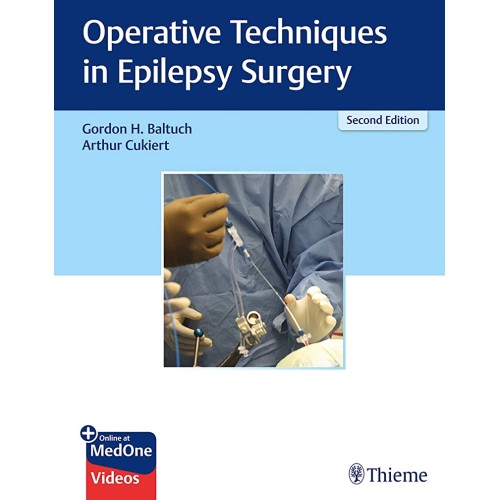 Operative Techniques in Epilepsy Surgery 2nd ed.