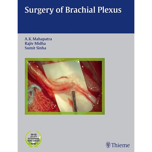 Surgery of Brachial Plexus