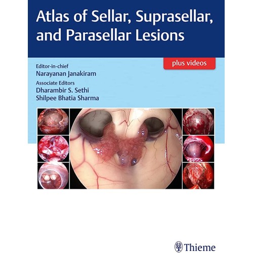 Atlas of Sellar, Suprasellar, and Parasellar Lesions 1st Ed.