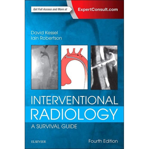 Interventional Radiology: A Survival Guide -4E