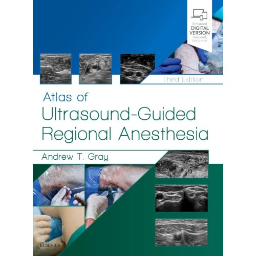 Atlas of Ultrasound-Guided Regional Anesthesia: Expert Consult -3E