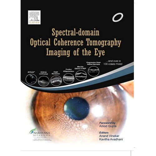 Spectral Domain Optical Coherence Tomography Imaging of the Eye