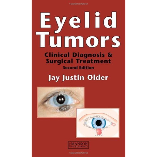 Eyelid Tumors 2/e