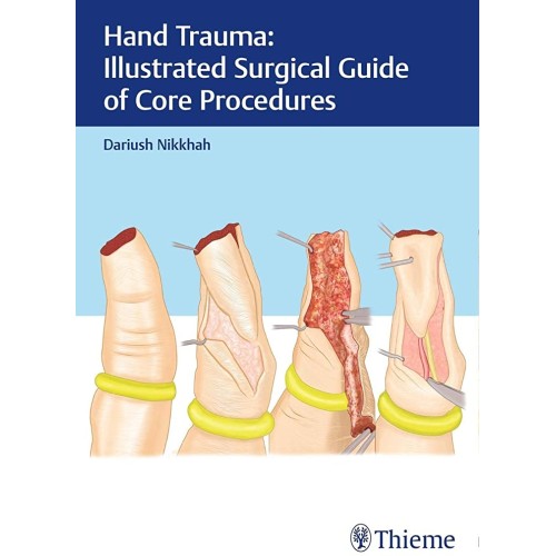 Hand Trauma: Illustrated Surgical Guide of Core Procedures 1st Ed.