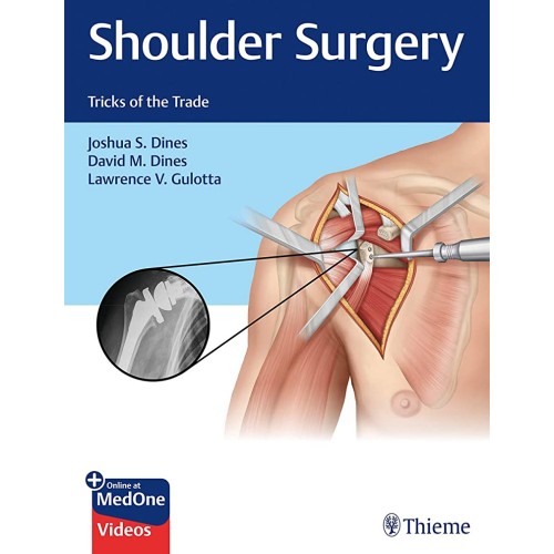 Shoulder Surgery Tricks of the Trade 1st Ed.