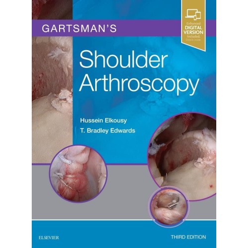 Gartsman's Shoulder Arthroscopy -3E