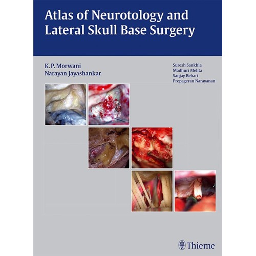 Atlas of Neurotology and Lateral Skull Base Surgery