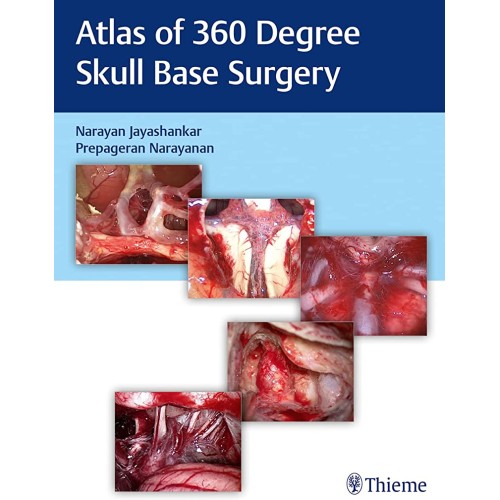 Atlas of 360 Degree Skull Base Surgery 1st Ed.