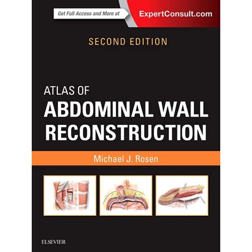 Atlas of Abdominal Wall Reconstruction -2E