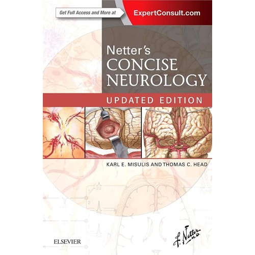 Netter's Concise Neurology -1E