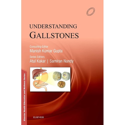 Understanding Gallistones - 1E