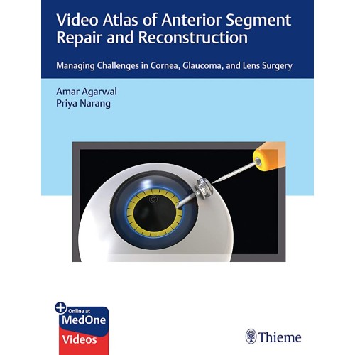 Video Atlas of Anterior Segment Repair and Reconstruction 1st Ed.