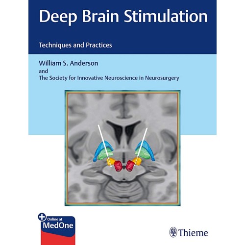 Deep Brain Stimulation : Techniques and Practices 1st Ed.