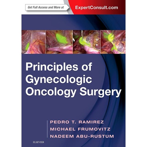 Principles of Gynecologic Oncology Surgery - 1E