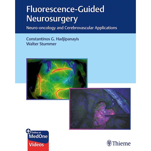 Flurescence - Guided Neurosurgery 1st Ed.