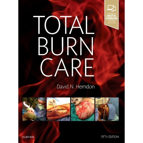 Total Burn Care - 5E