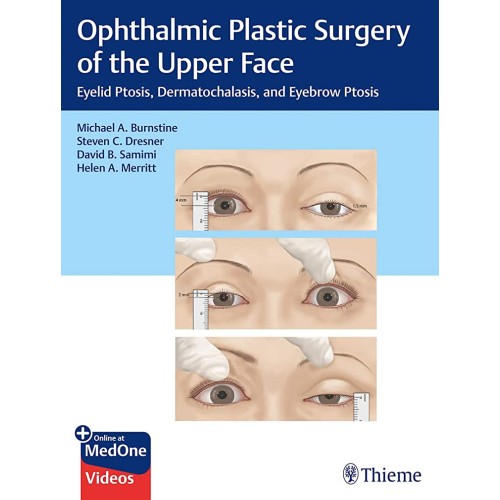 Ophthalmic Plastic Surgery of the Upper Face ...