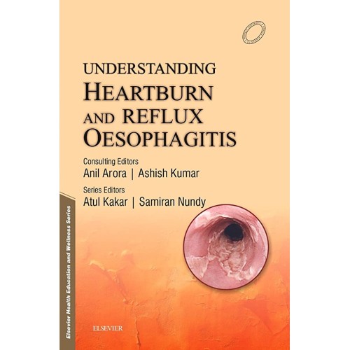 Understanding Heartburn & Reflux Oesophagitis...