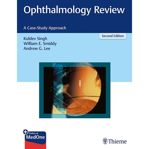 Ophthalmology Review 2nd Ed.