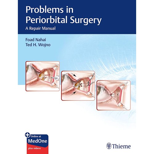 Problems in Periorbital Surgery : A Repair Manual 1st Ed.