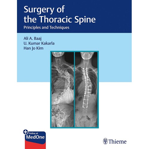 Surgery of the Thoracic Spine 1st Edition