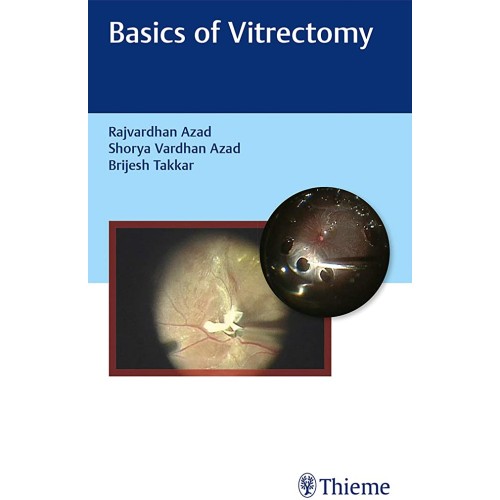 Basics of Vitrectomy 1st Edition